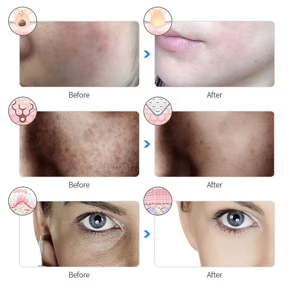 Rechargeable Facial LED Mask 7 Colors LED Photon Therapy Beauty Mask Skin Care